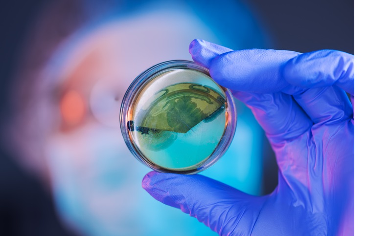 Female scientist analyzing growing bacterial cultures in petri dish in laboratory, science and microbiology background