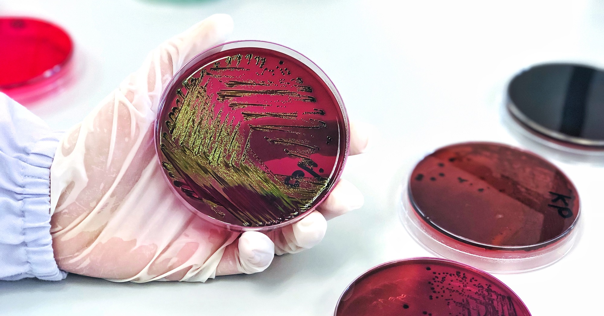 Escherichia coli (E.coli) cultured with Eosin Methylene Blue (EMB) Agar in Petri dish show the metallic green sheen colonies, hold in scientist hand in medical health laboratory for analysis disease.