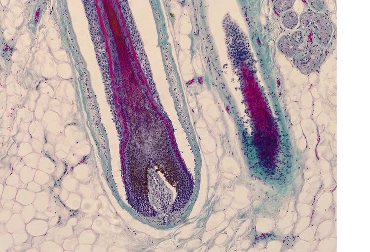 Microscopic picture (400x magnification) of roots of hair in human head skin. Hair follicles.