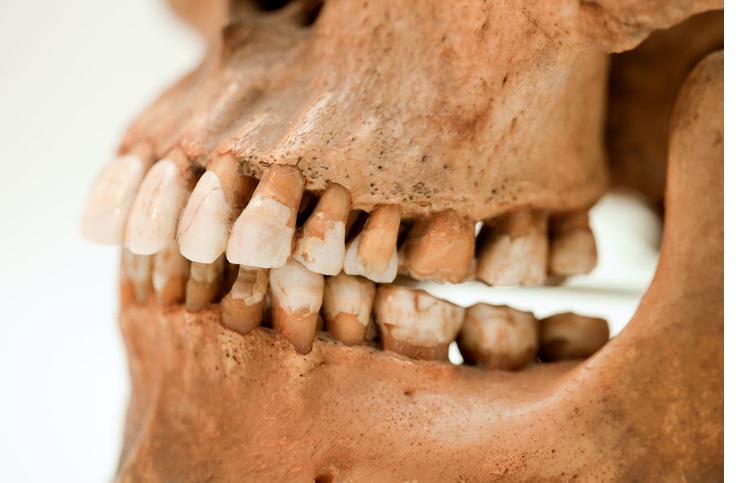 archaeological teeth