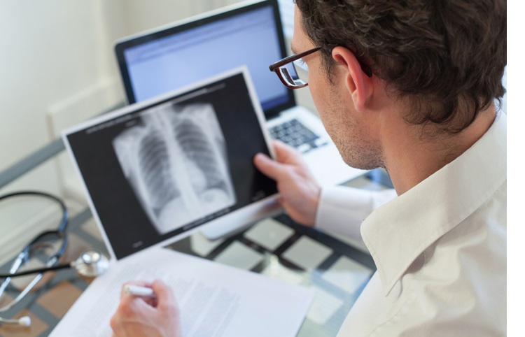 Lung xrays for TB