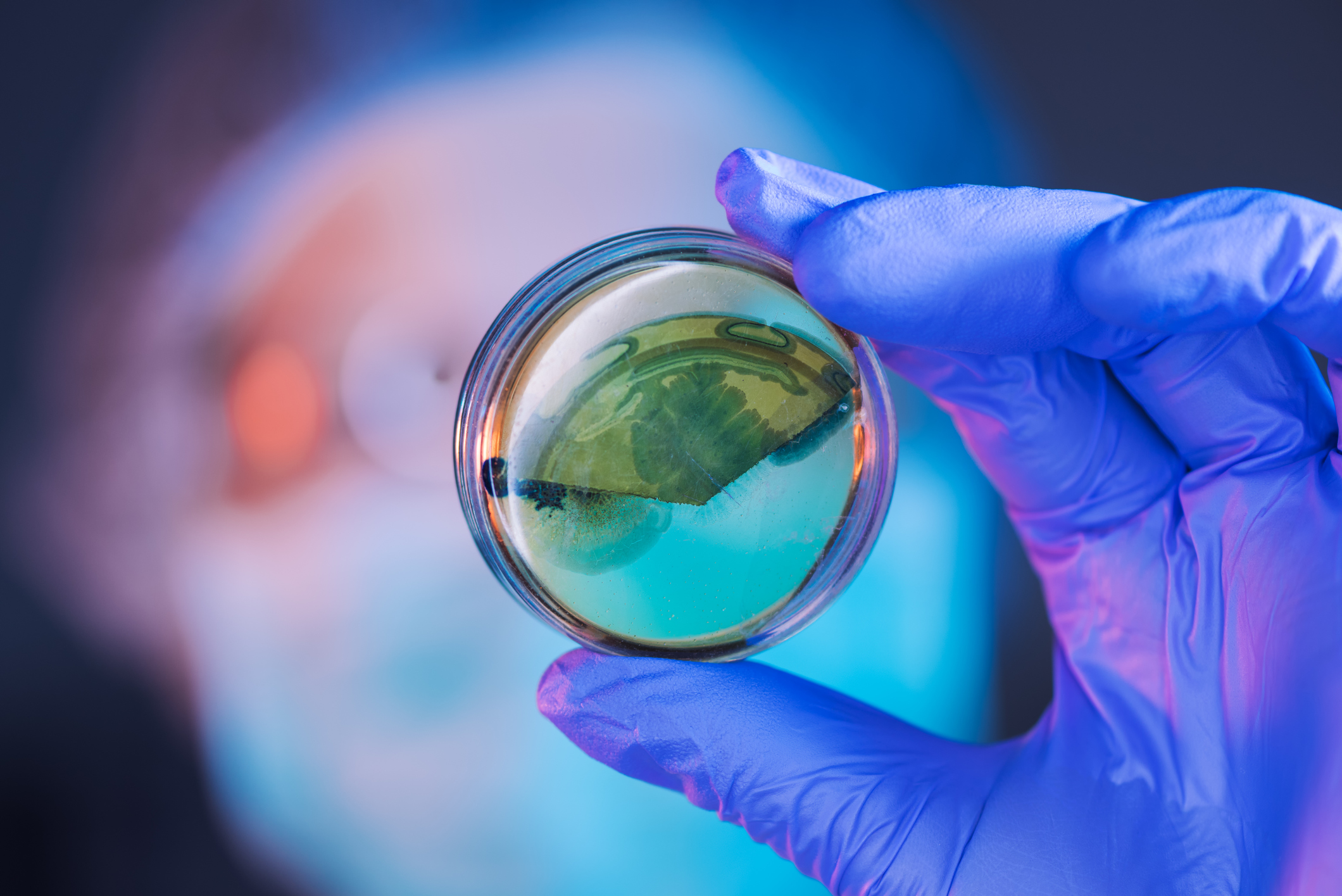 Female scientist analyzing growing bacterial cultures in petri dish in laboratory, science and microbiology background