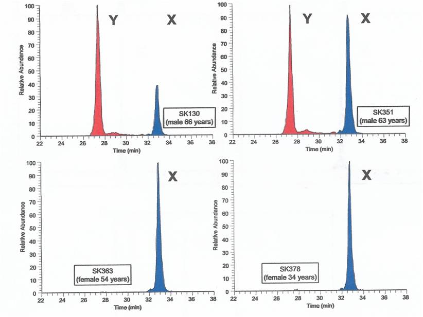 Results of Peptide Identification - Ultrapure Water